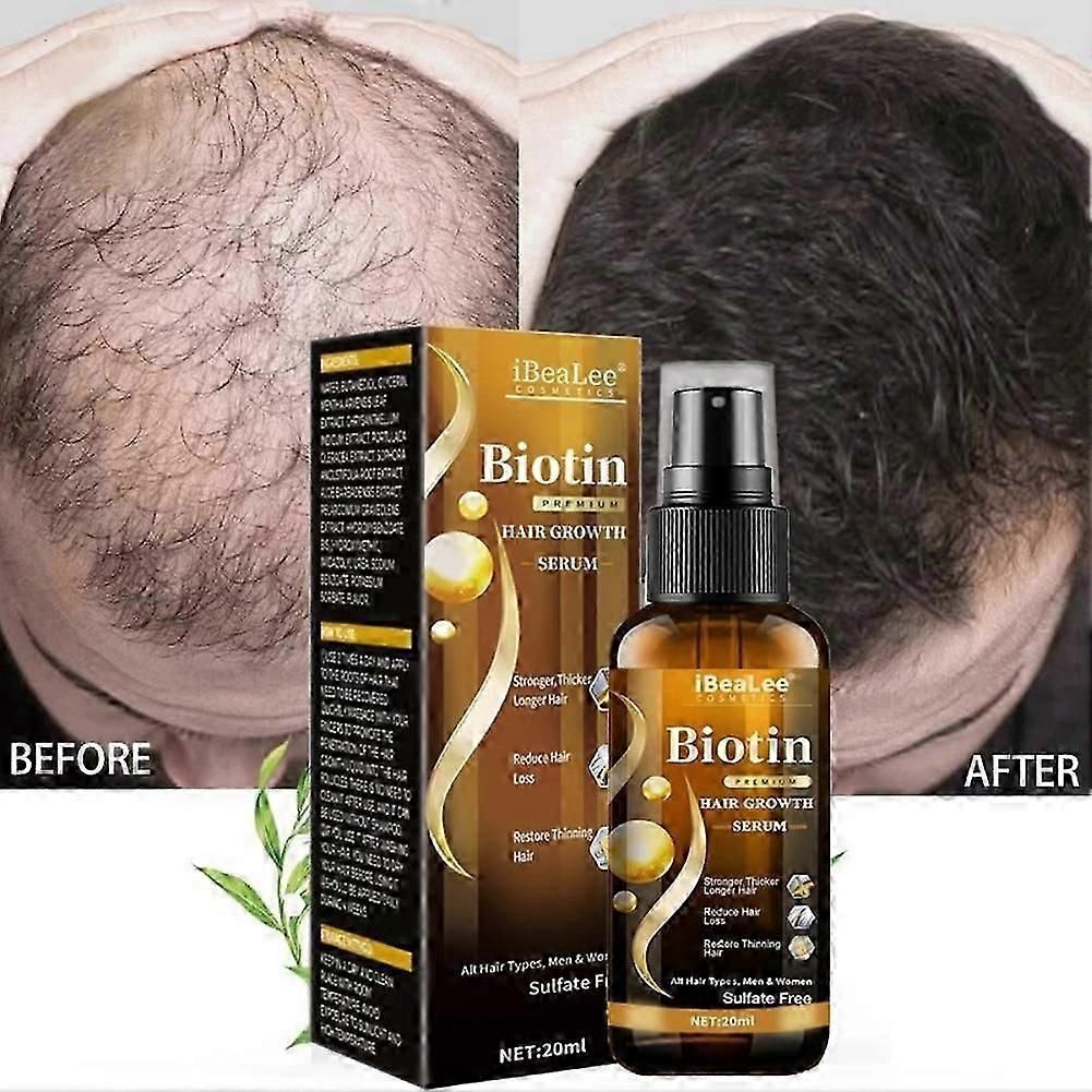 Biotin Anti Fast Regeneration Scalp