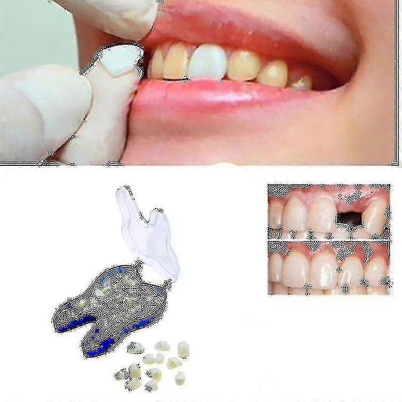 Temporary Denture Braces Occlude Upper Dentures, Veneer Dentures, Missing Teeth-CE