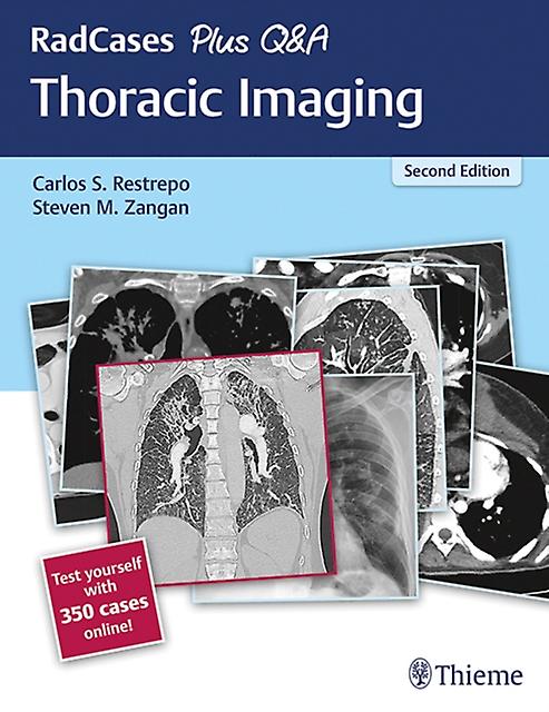 Radcases Plus Qa Thoracic Imaging Paperback Book