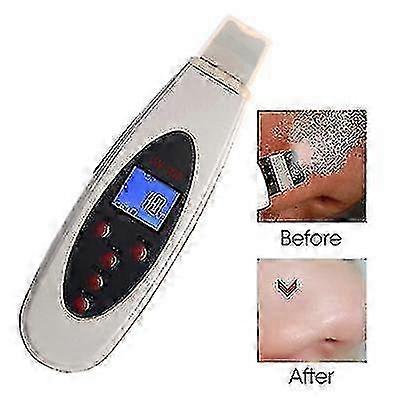 スキンケア用 LCD デジタルディスプレイ付きハンドヘルド超音波電子美容装置