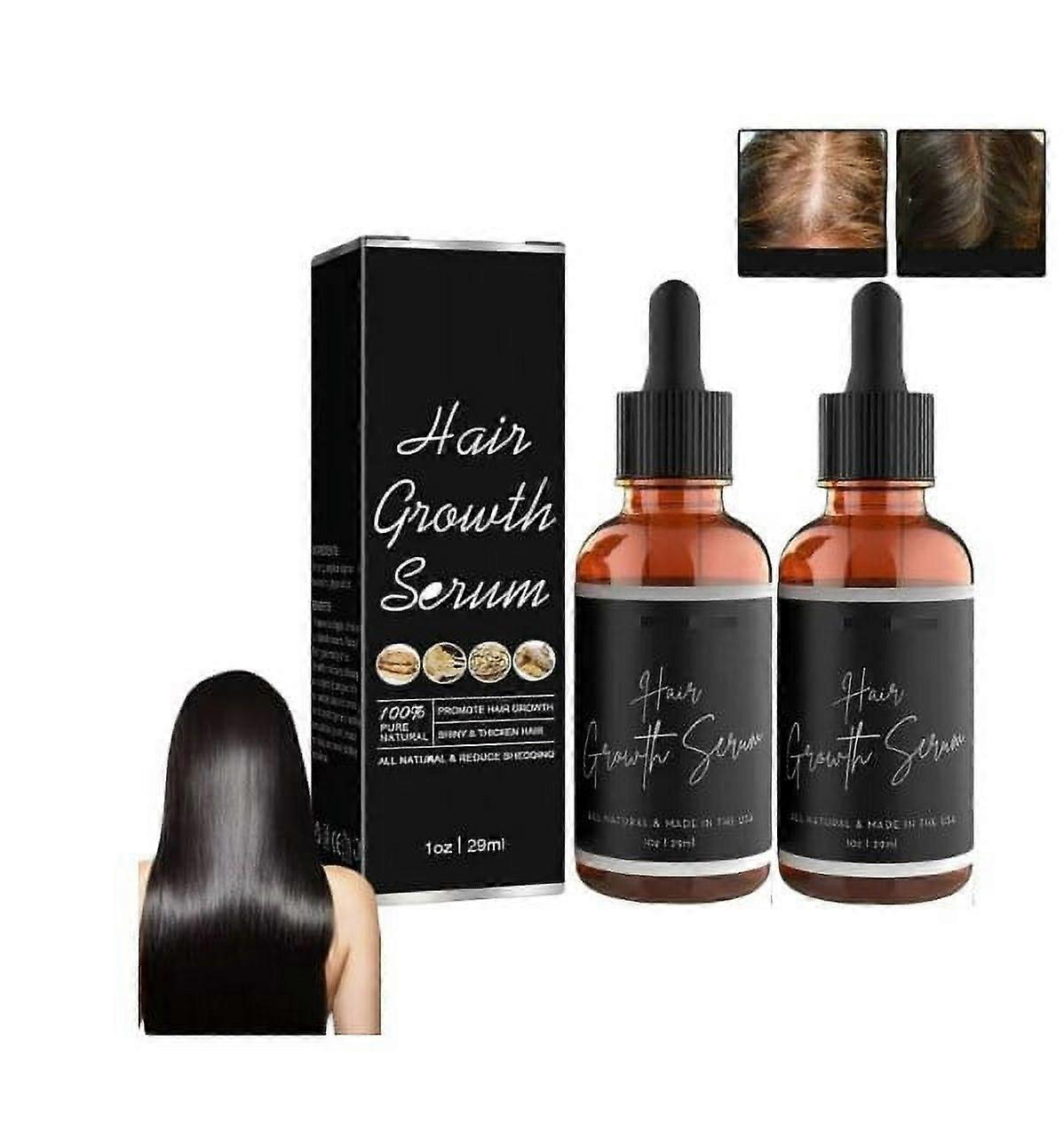 育毛美容液アフリカオリーブ、白人黒人女性のための育毛美容液、脱毛のための育毛油、ヘアセラム、ヘアファストナチュラルヘアグロース