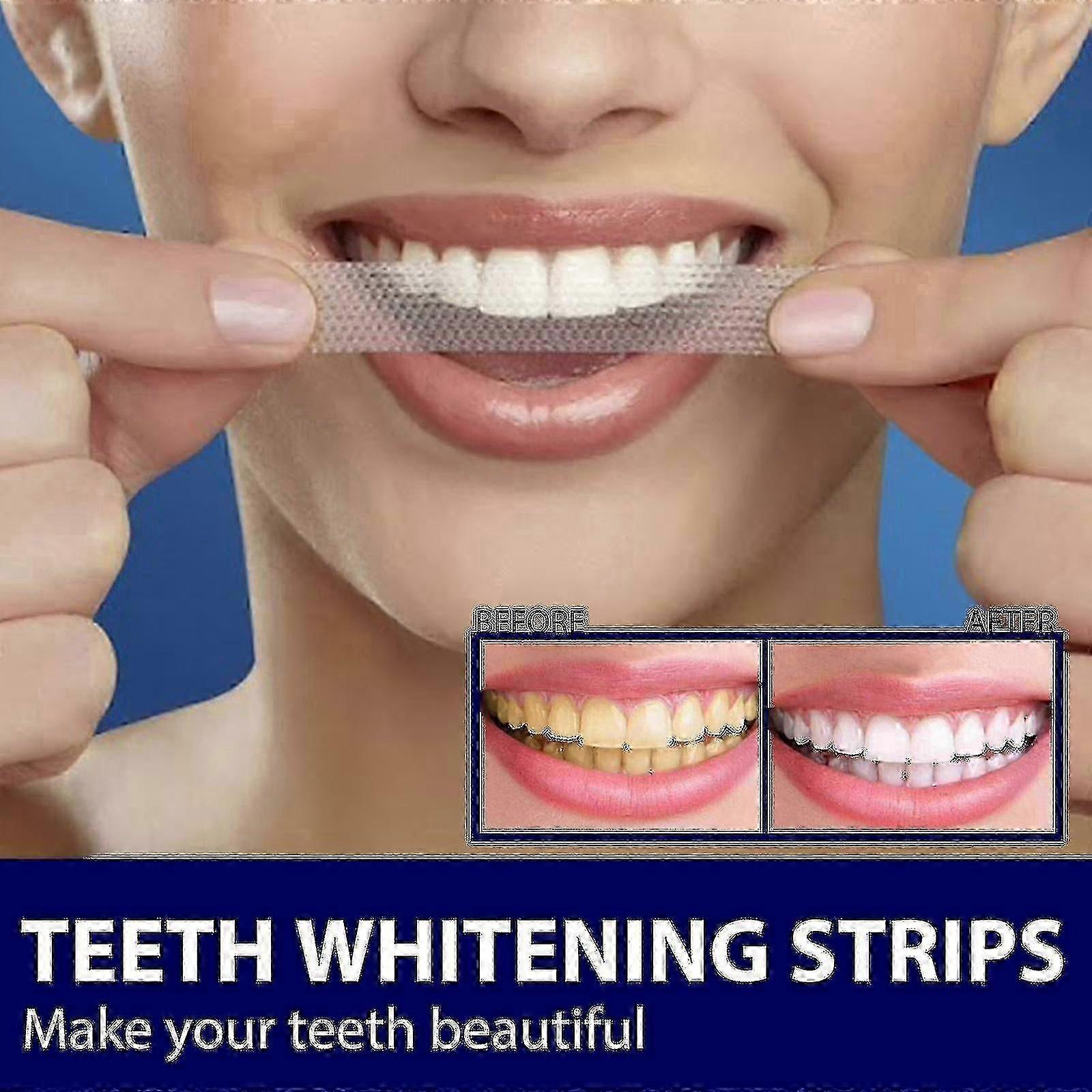 Eelhoe Teeth Remove Teeth Tartar Stains Toba