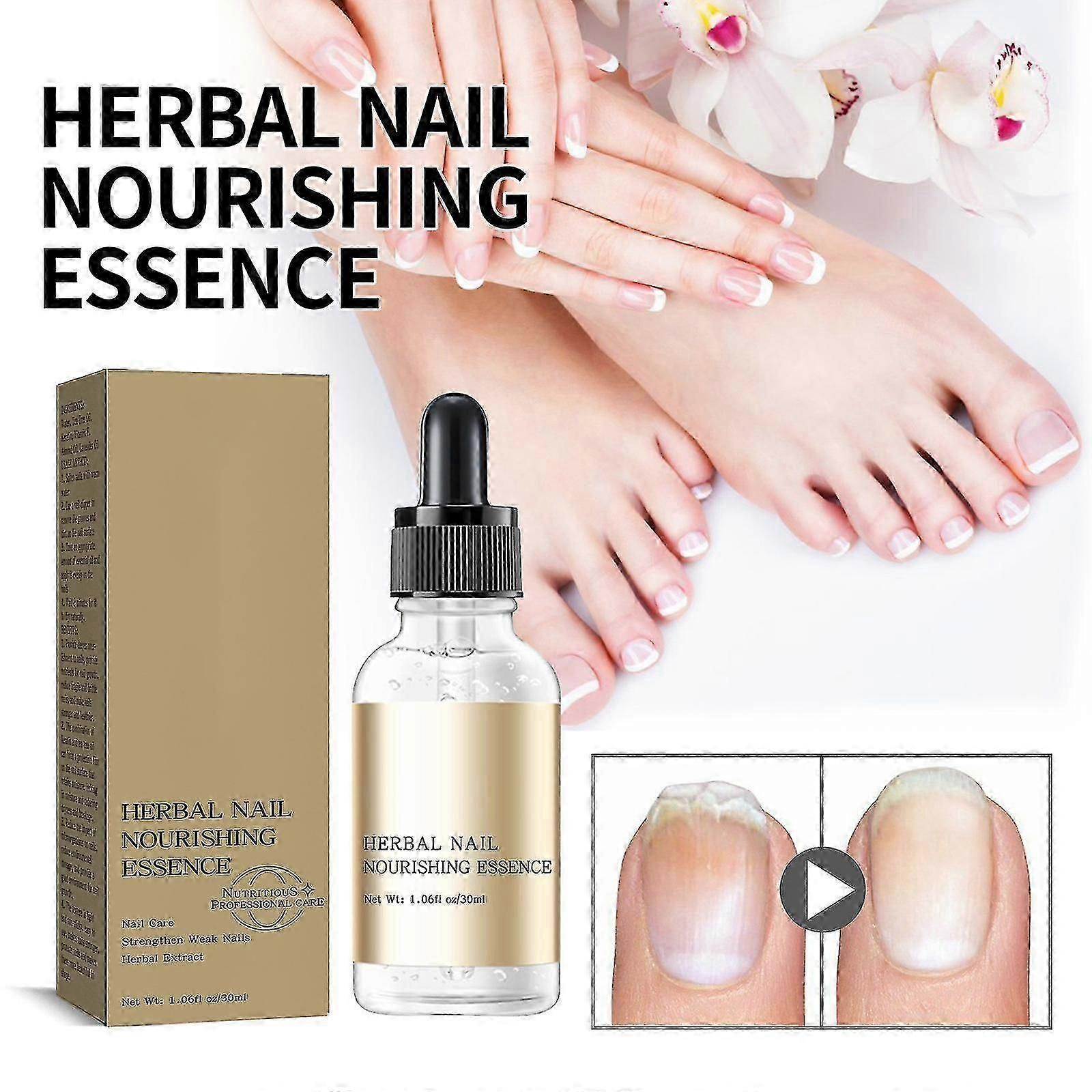 Essence de traitement des ongles, Solution de réparation des ongles pour les ongles épaissis et incarnés, Liquide de renouvellement des ongles Restore Healthy Nails