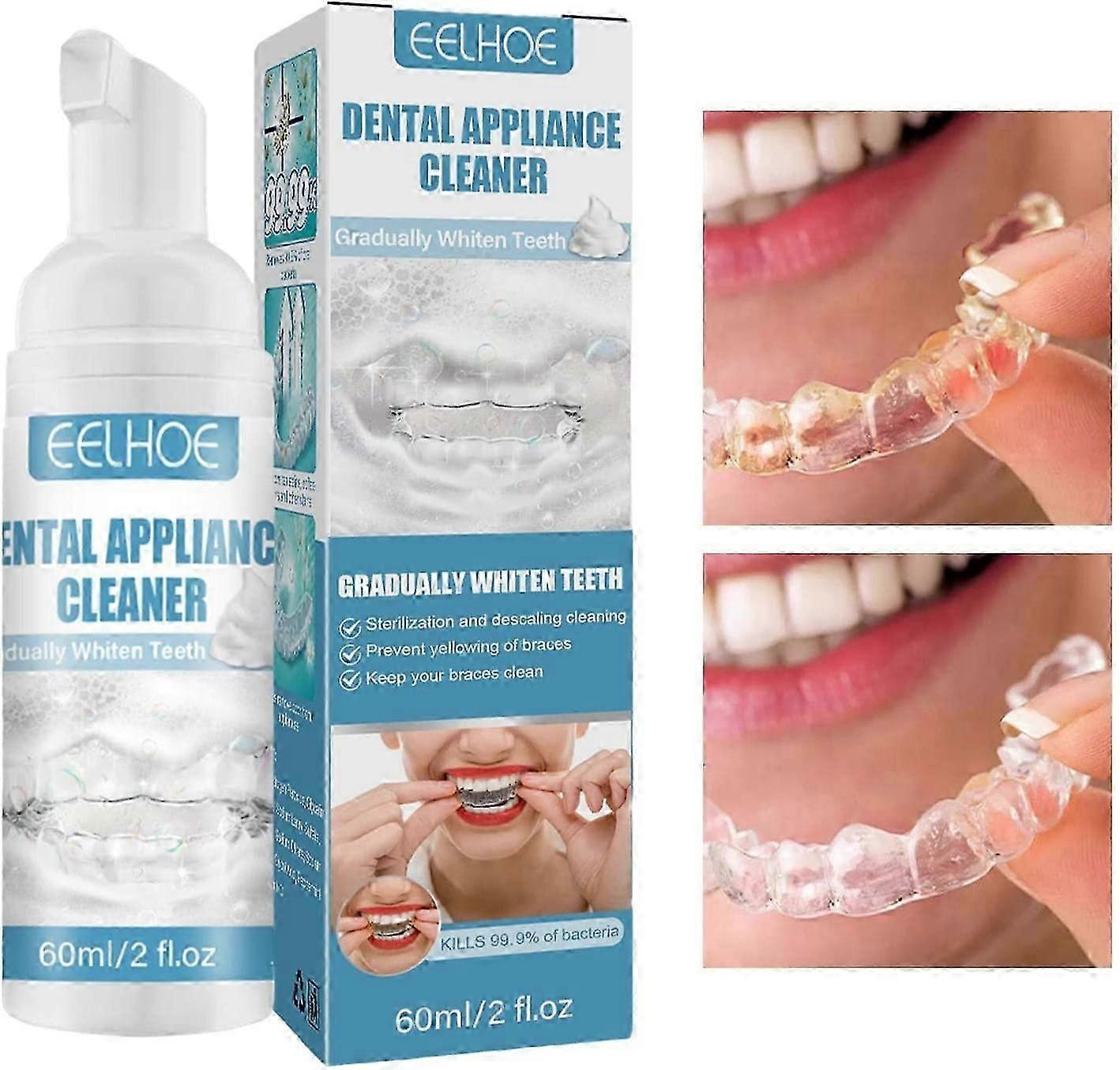 3PCS Foaming Braces Cleaner,Denture Whitener Toothpaste - Freshening Spray Cleanser for Aligners, Mouth Guards & Night Guards - Easy Cleaning, 2 Ounce