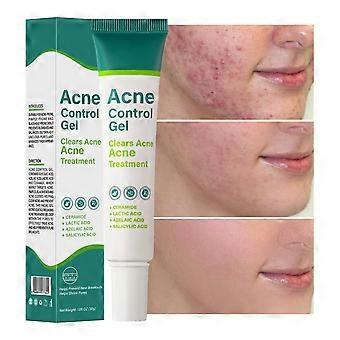 Acne Control Gel, Skin Smoothing Facial Gel, for BlemishProne Skin 30g