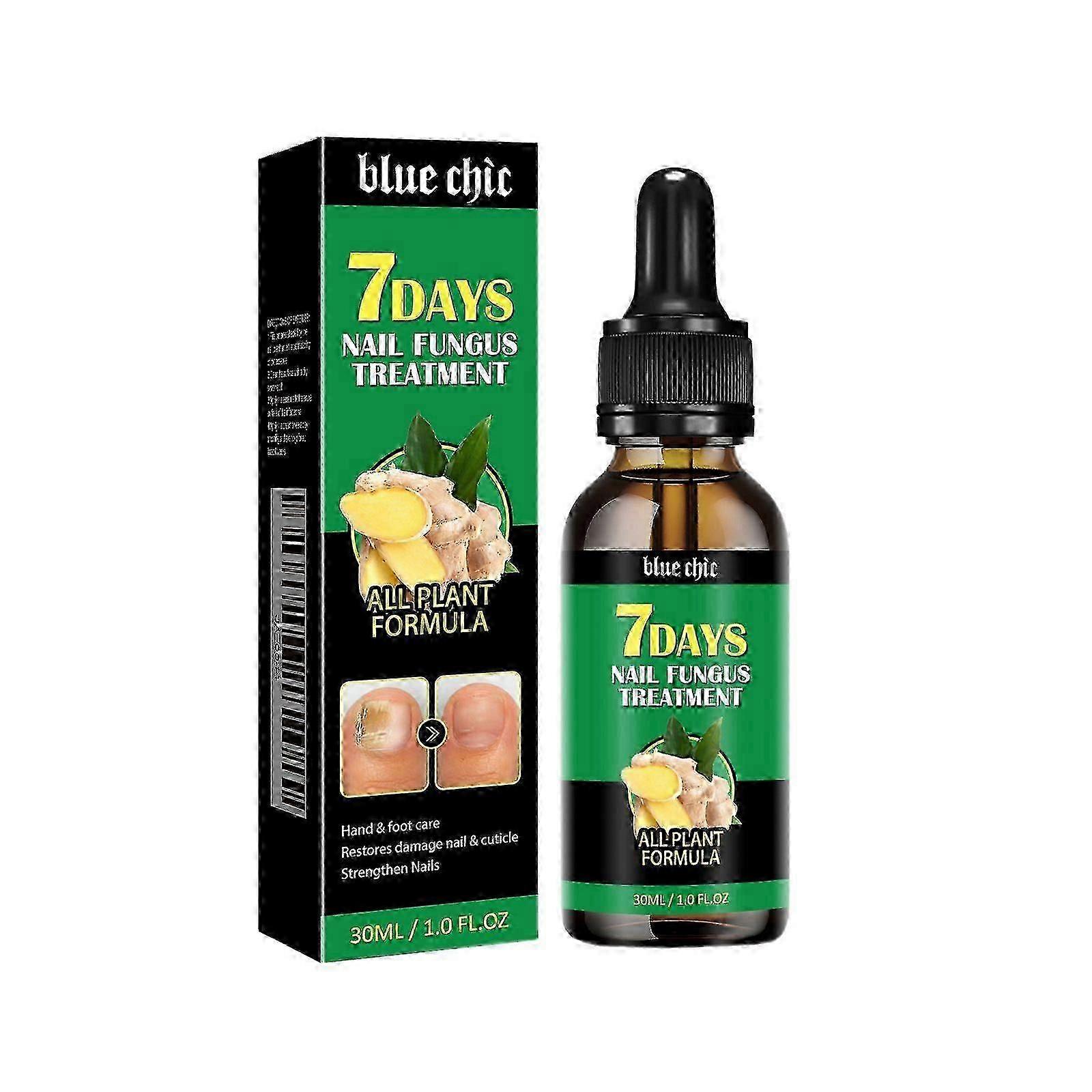 Tånagelsvamp Nagelbehandling Extra stark ingefära nagelbehandling Nagelstöd Nagelvård, Nagelbehandling, Nagelstärkande ingefära nageltillväxtserum