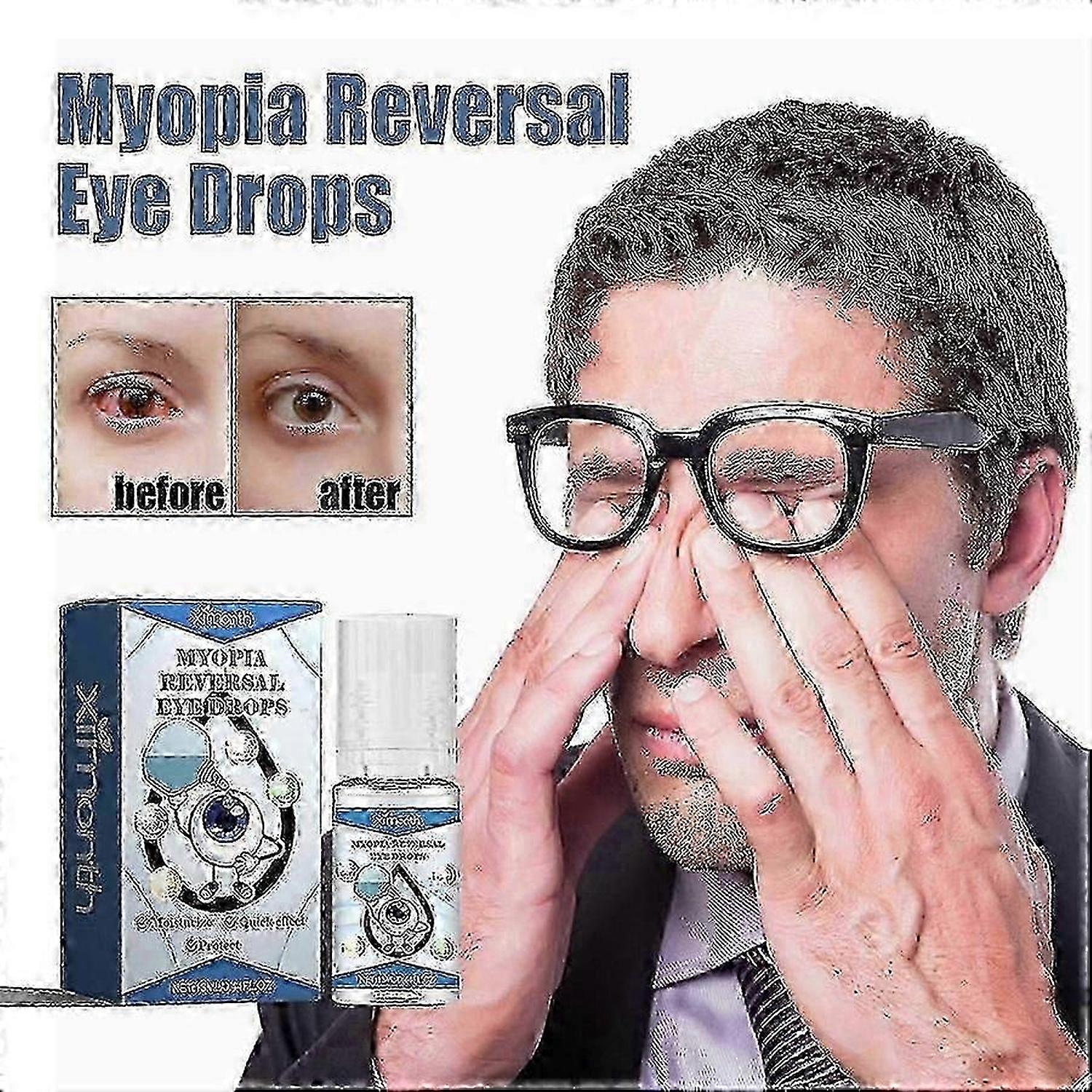 白内障緩和のための点眼薬は視力を改善し、乾燥したかゆみを伴う赤目を治療します