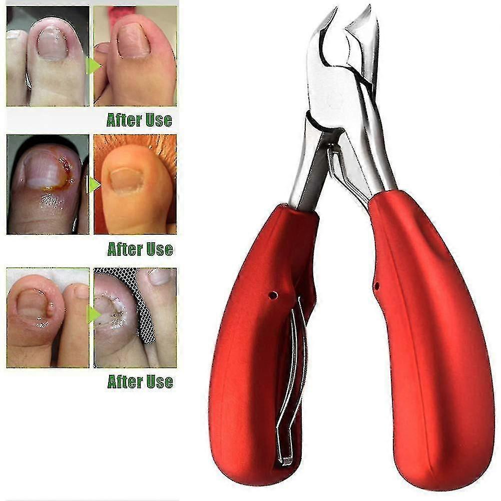 Επαγγελματικό toenail Clipper για παχιά ή ingrown νύχια - ακρίβεια καρφί clipper με ευθεία Ed