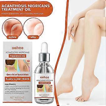 Packung mit 2 Acanthosis Nigricans Behandlungsöl 50ml