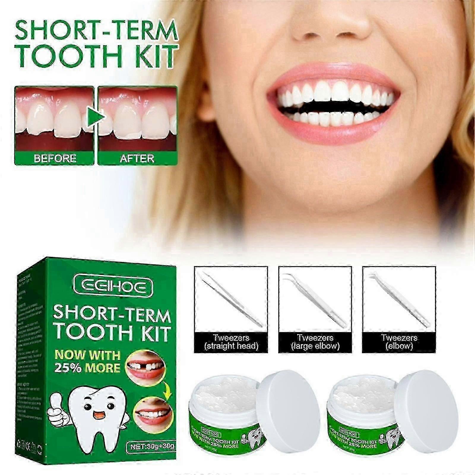 Temp Missing Tooth Replacement Kit - 25% Better Than Others - Temp Fix for Lucky B Brand