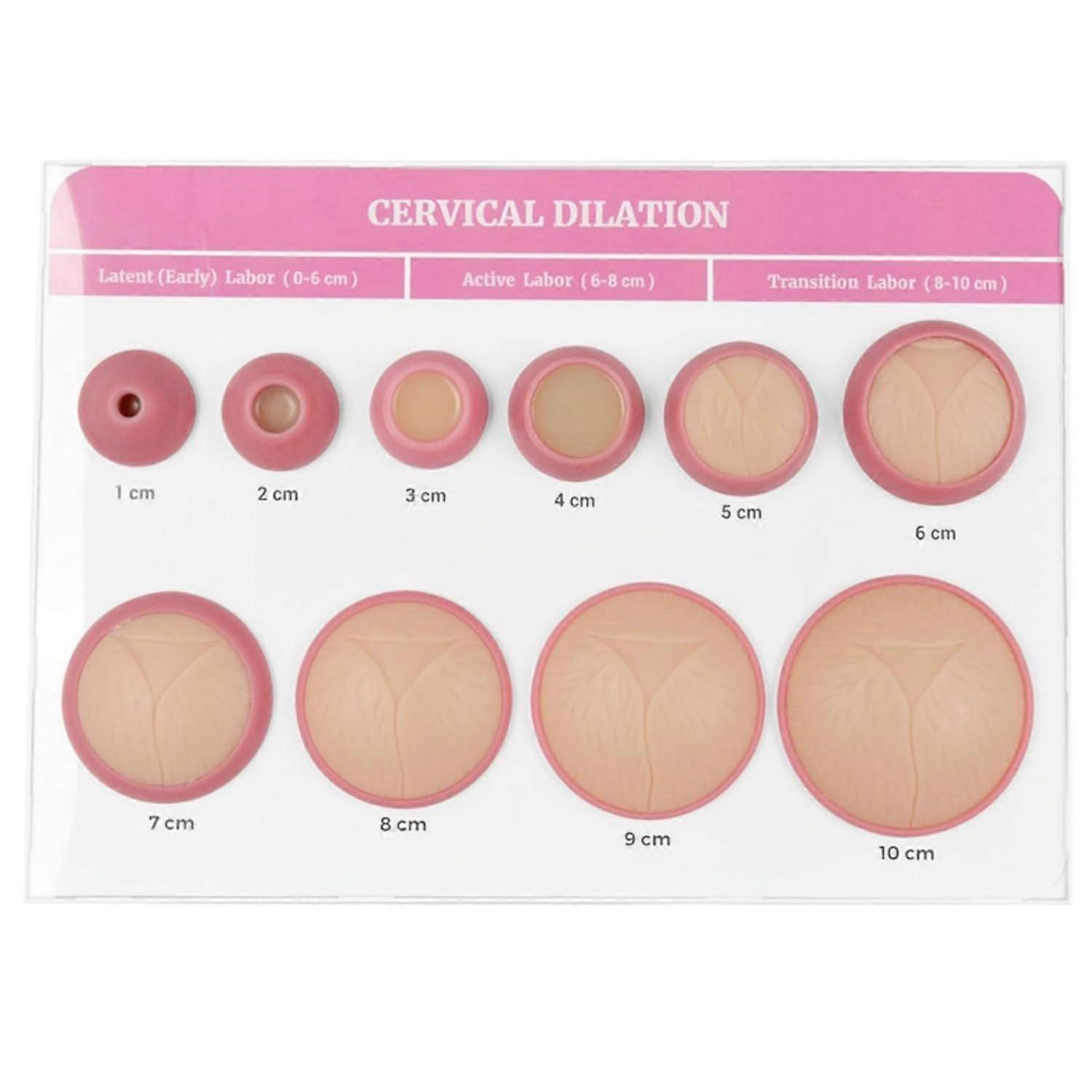 Cervical Dilation Model 010cm Simulator with Full Visualization for Midwife and Doula Training