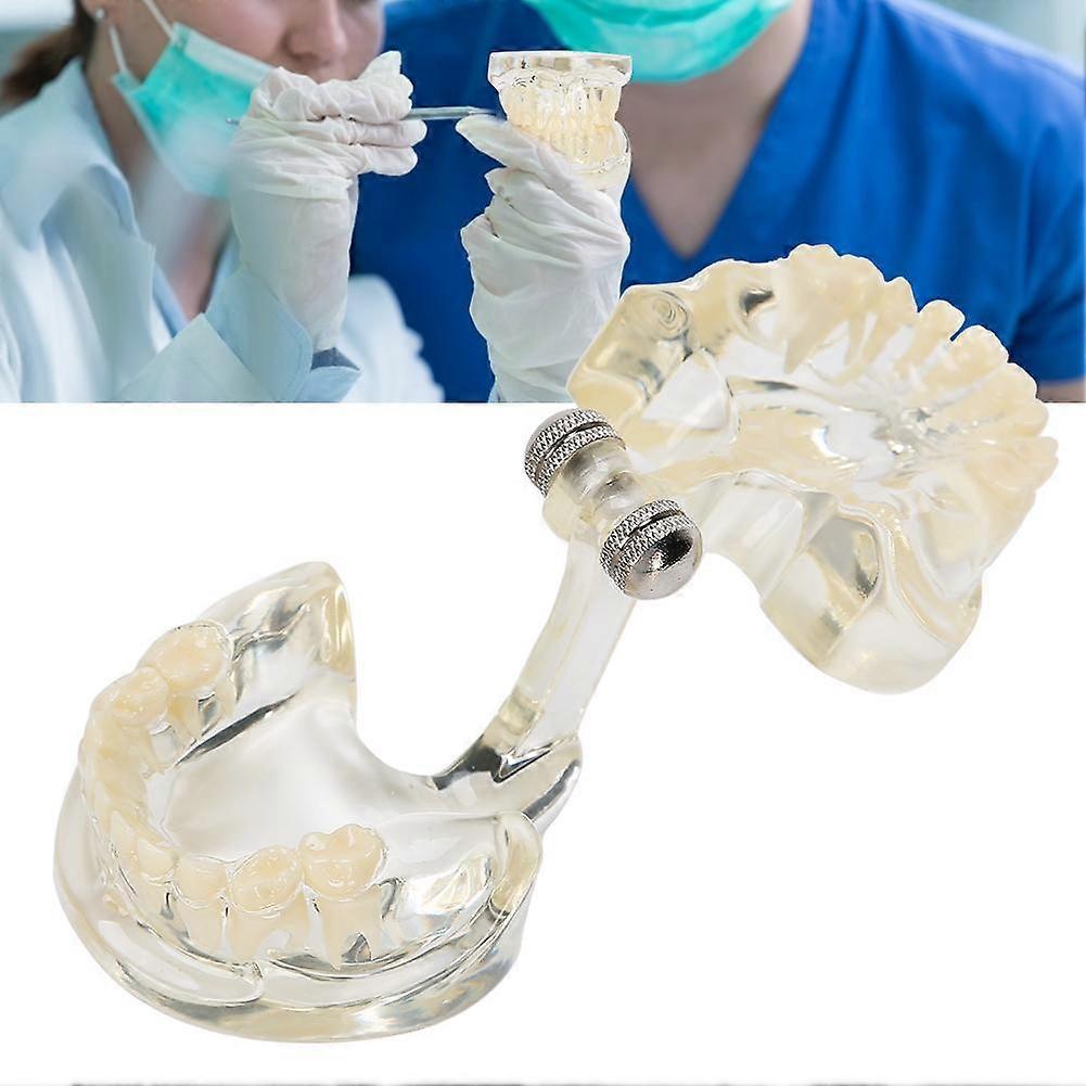 Dental Deciduous Teeth Model Removable Teeth Model Teaching Tool for Dentist