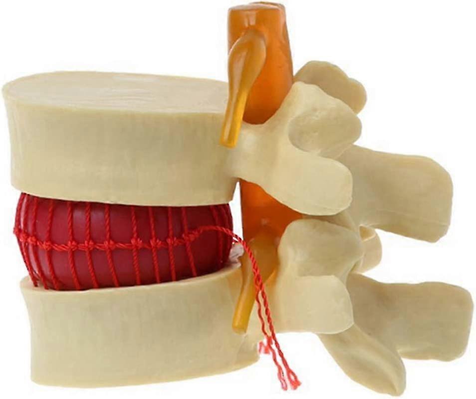 Lumbar Model Anatomy Spine Lumbar Disc Herniation Anatomy Teaching Tool Lumbar Model