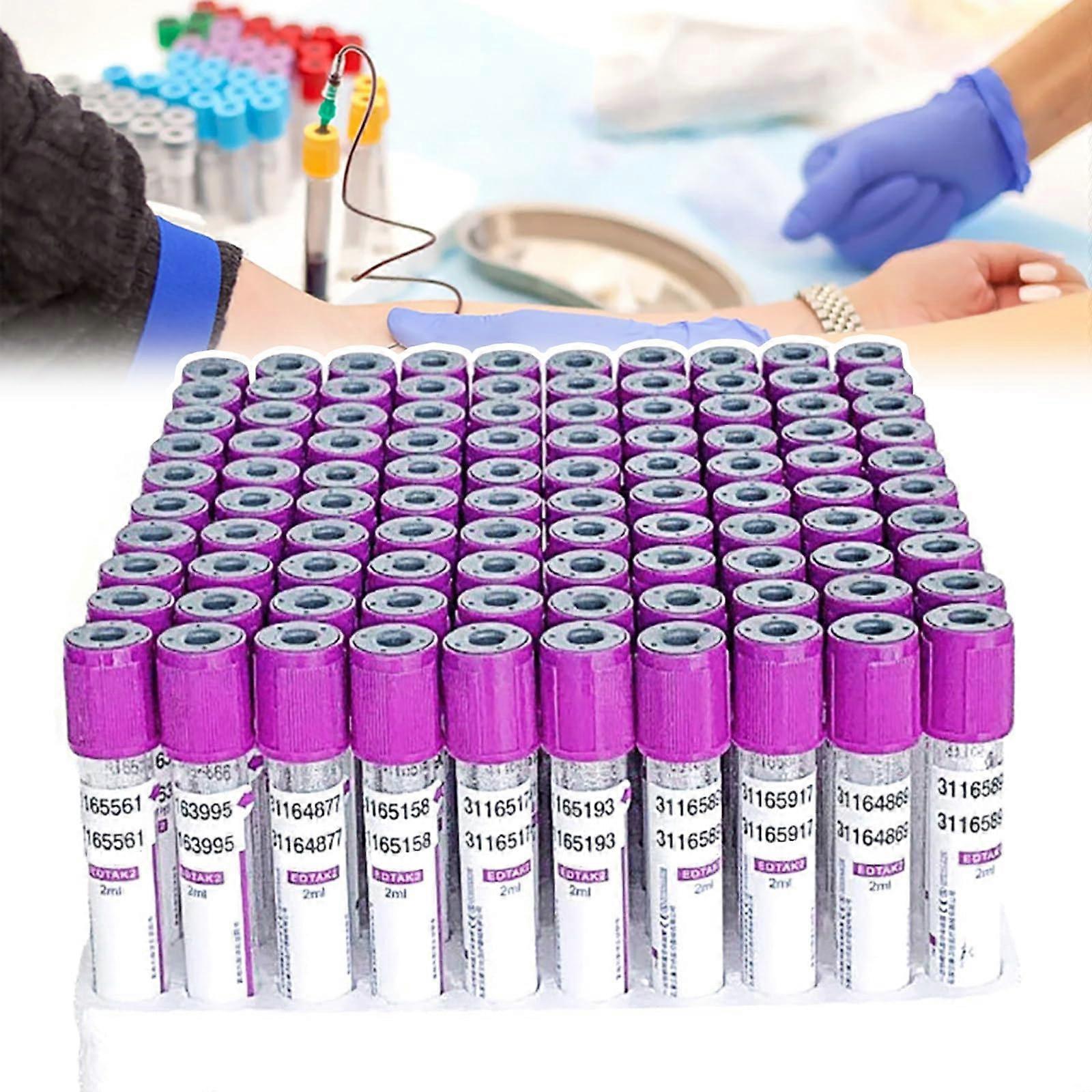 100 Pieces Vacutainer Blood Collection Tubes (2ml/3ml/5ml/10ml), EDTA K2, Glass, Screw Cap