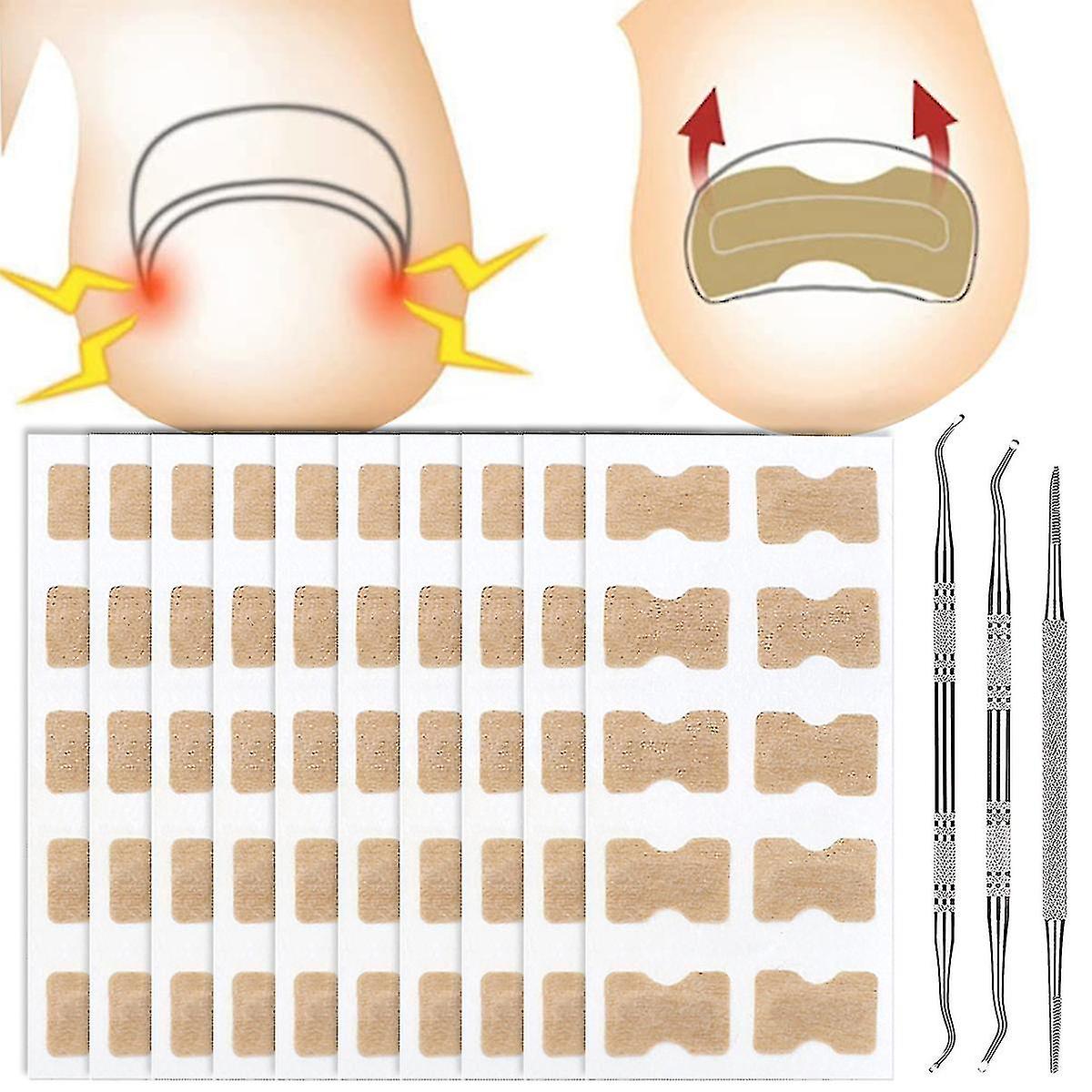 100 Pcs Ingrown Tonail Corrector Autocollants Respirant Auto-adhésif Elastic Toenail Correction Patch Nail Correction Tool Manucure Set For