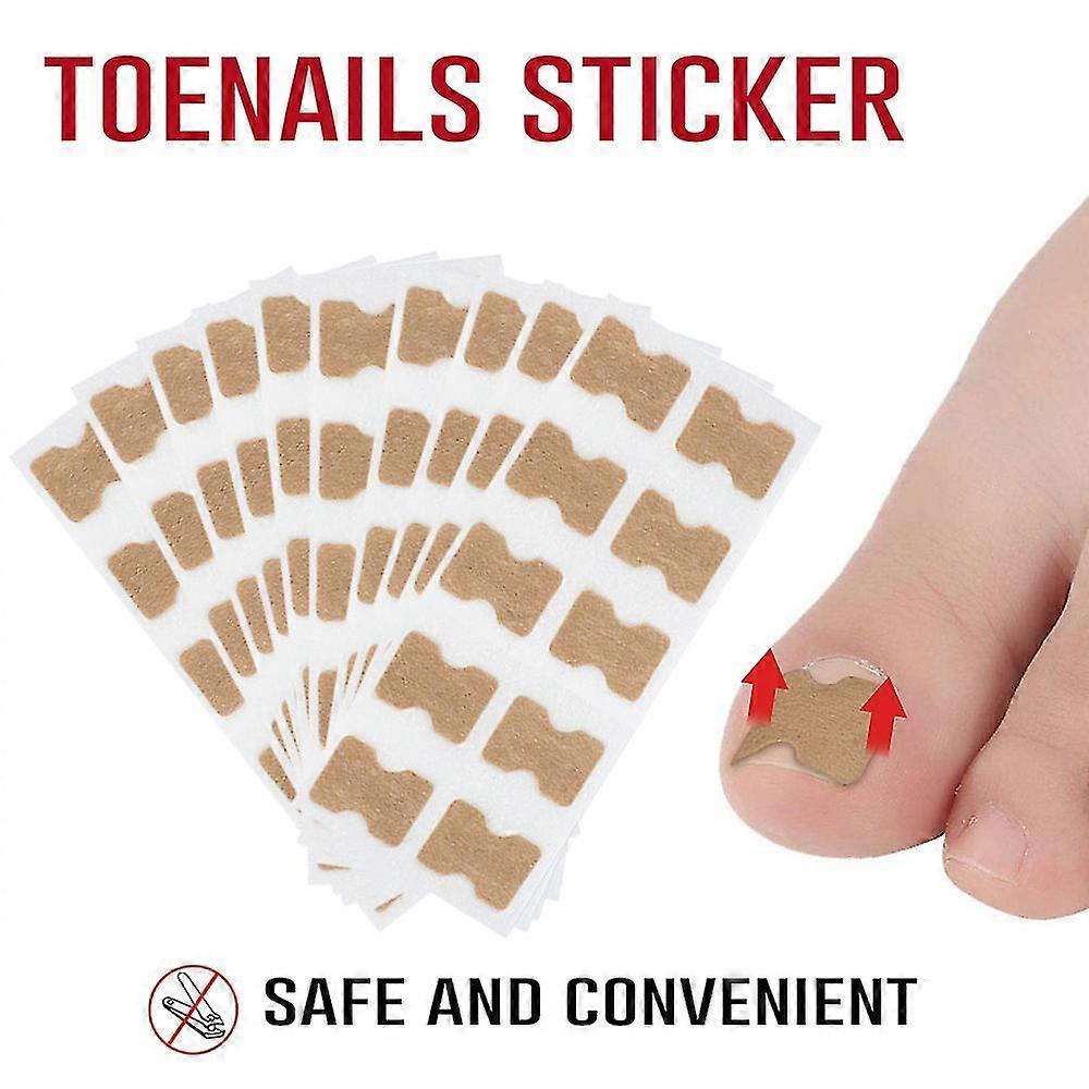 Toenail Correction Patch 10pcs Corrector Pedicure Tools Toe Nail Ingrown Toenail