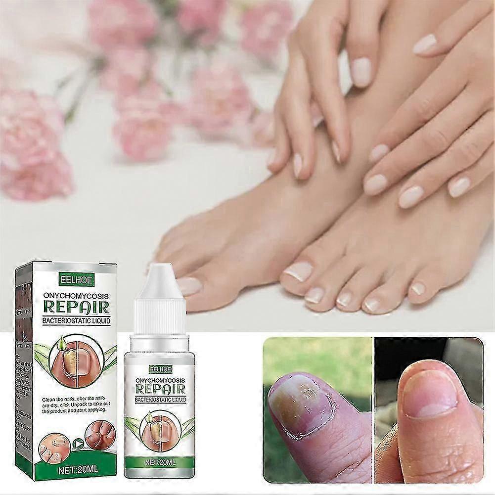 2pcs EELHOE抗真菌治療真菌効果的な指のつま先の爪の修理液溶液