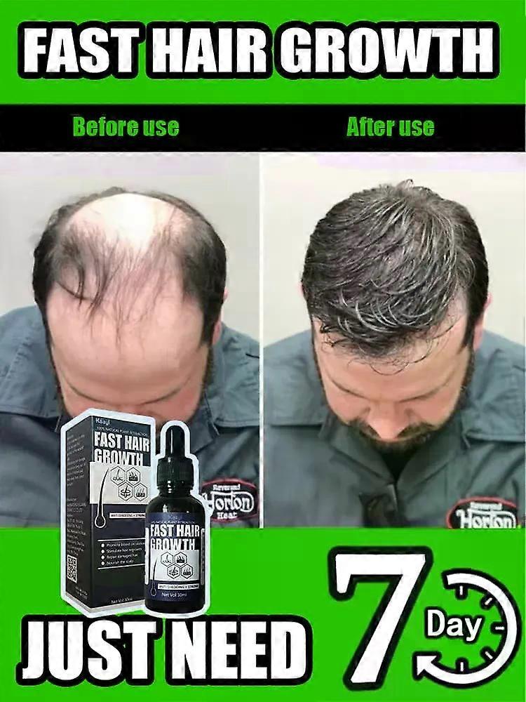 Estimule o crescimento do cabelo
