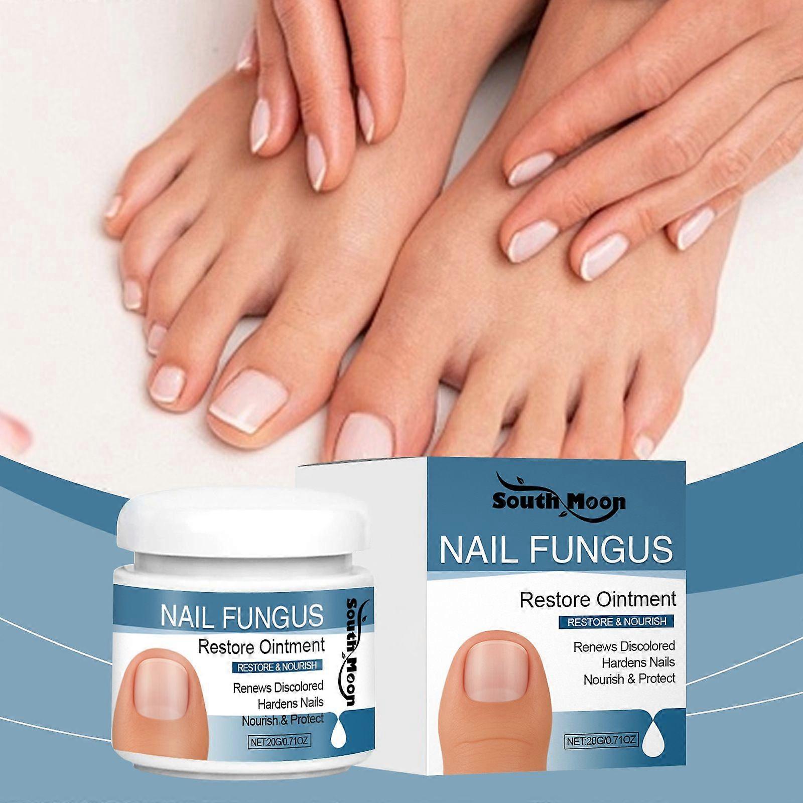 Nail Fungas Treatmet Cream, Κρέμα περιποίησης νυχιών, Μυκητιασική θεραπεία νυχιών για τα νύχια των ποδιών πολύ ισχυρή, βελτιώνει την εμφάνιση των νυχιών & Λύση αποκατάστασης νυχιών, θρέφει