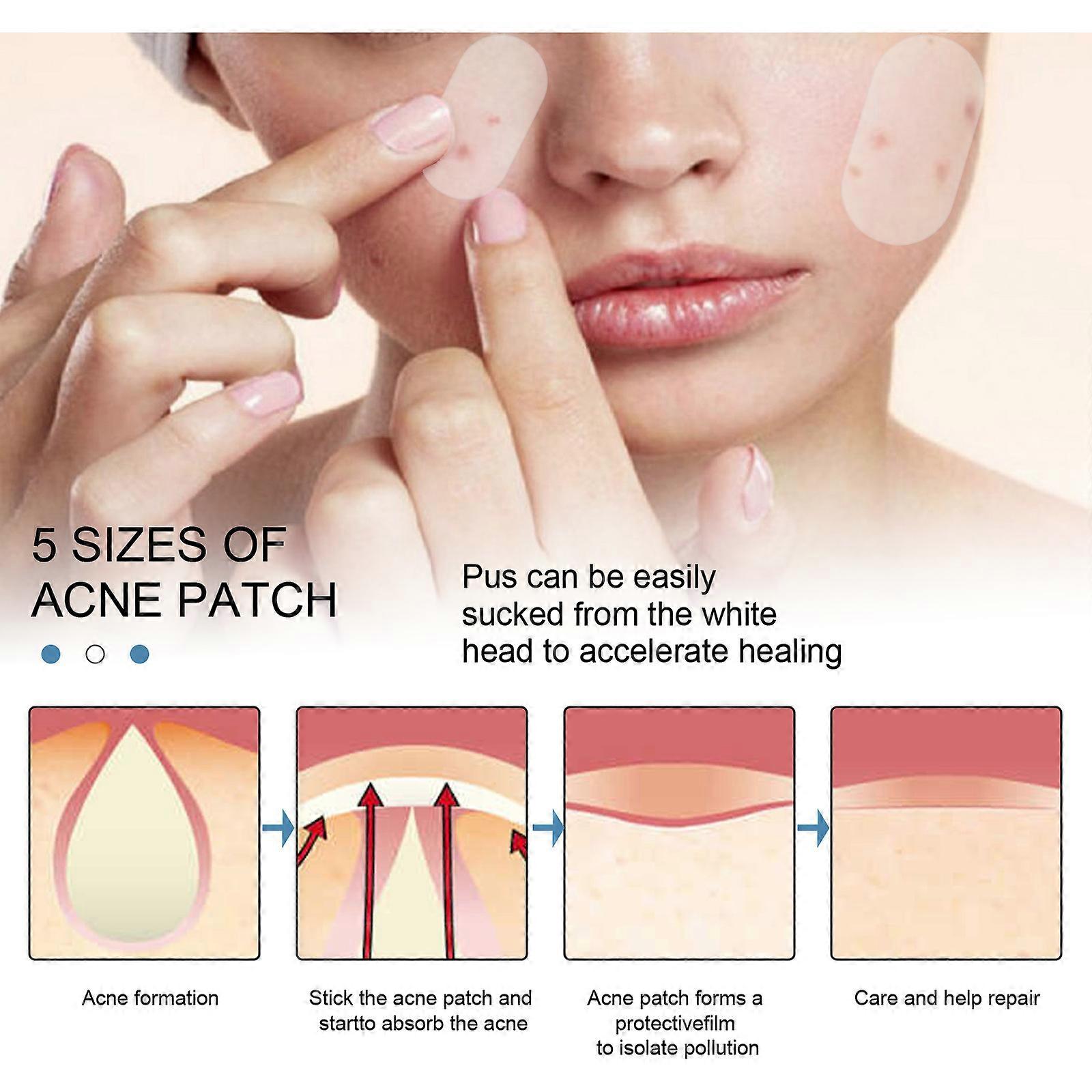 Invisible Acne Absorbing Cover Patch Hydrocolloid Acne Pimple Patch