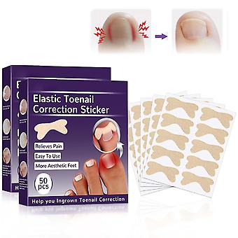 Ingrown Toenail Corrector Nail Correction Patches for Men Women Ingrown Toenail Treatment Ingrown Toenail Removal Kit 100PCS