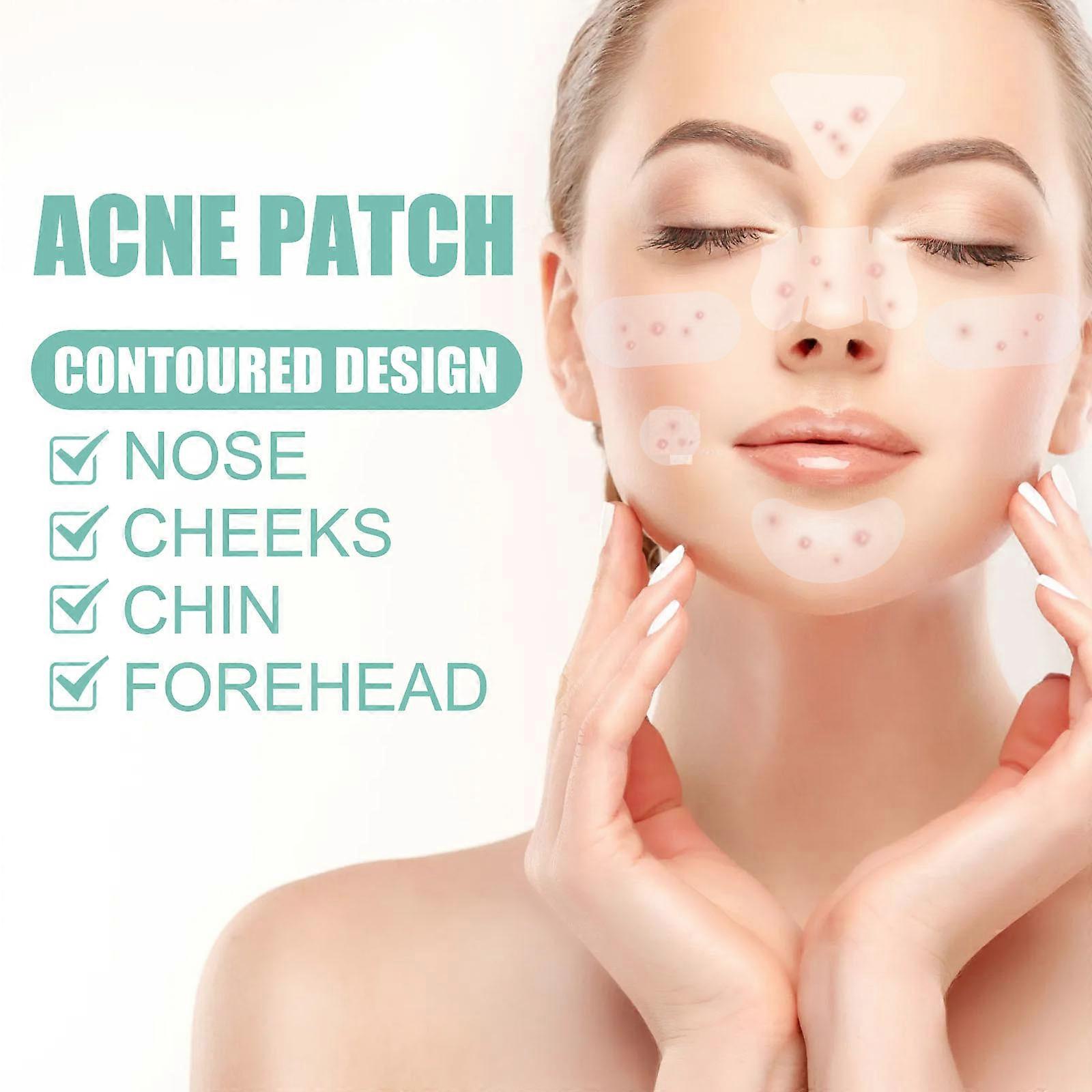 ZATKTK Pimple Patches (6 Sizes 138 Patches), Acne Patches For Large Zit Breakouts...