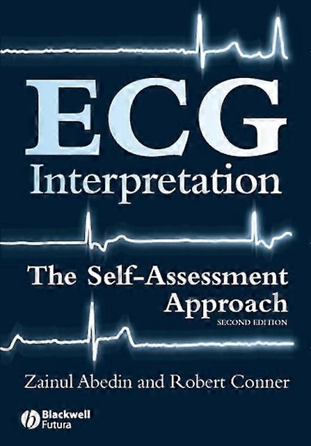 Ecg Interpretation by Robert Conner Paperback