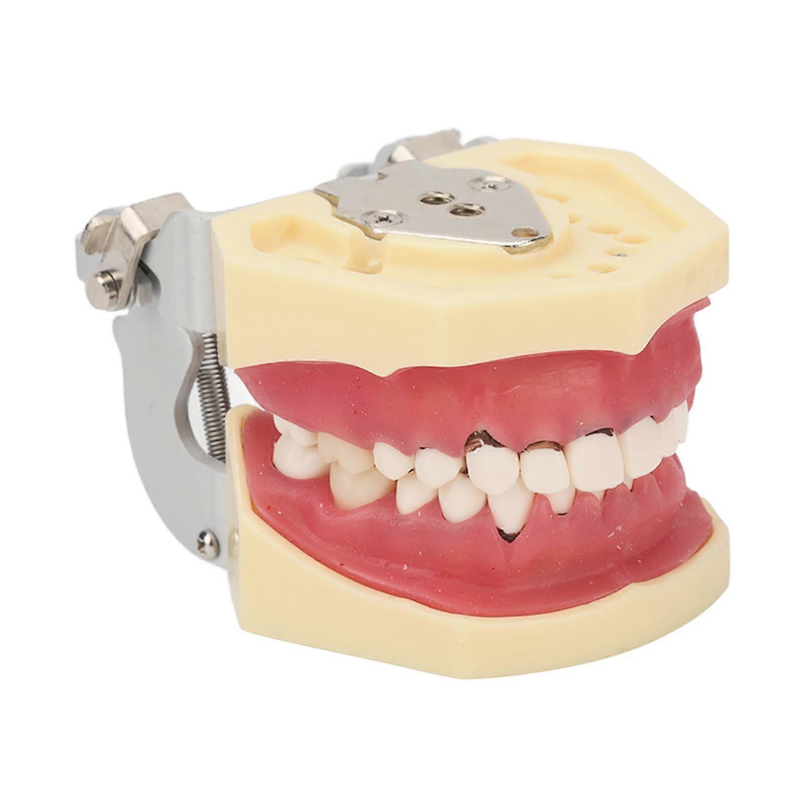 Periodontal Disease Teeth Resin Model Dental Demonstration Teeth Model for Teaching Studying