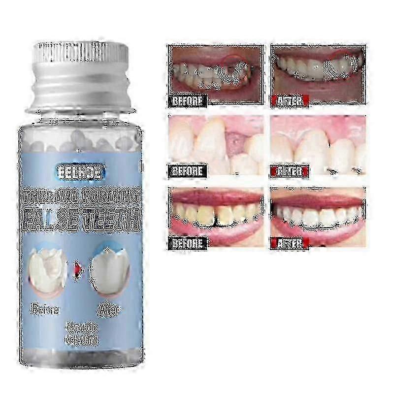 Super Strong Moldable Teeth Glue for Temporary Denture Repair and Filling Gaps in False Teeth