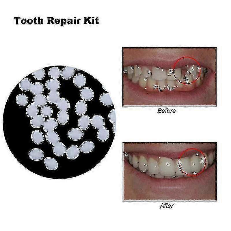 26-27 100g Temporary Tooth Filling Material Missing Teeth Tool Hygiene Teeth-hy 10g