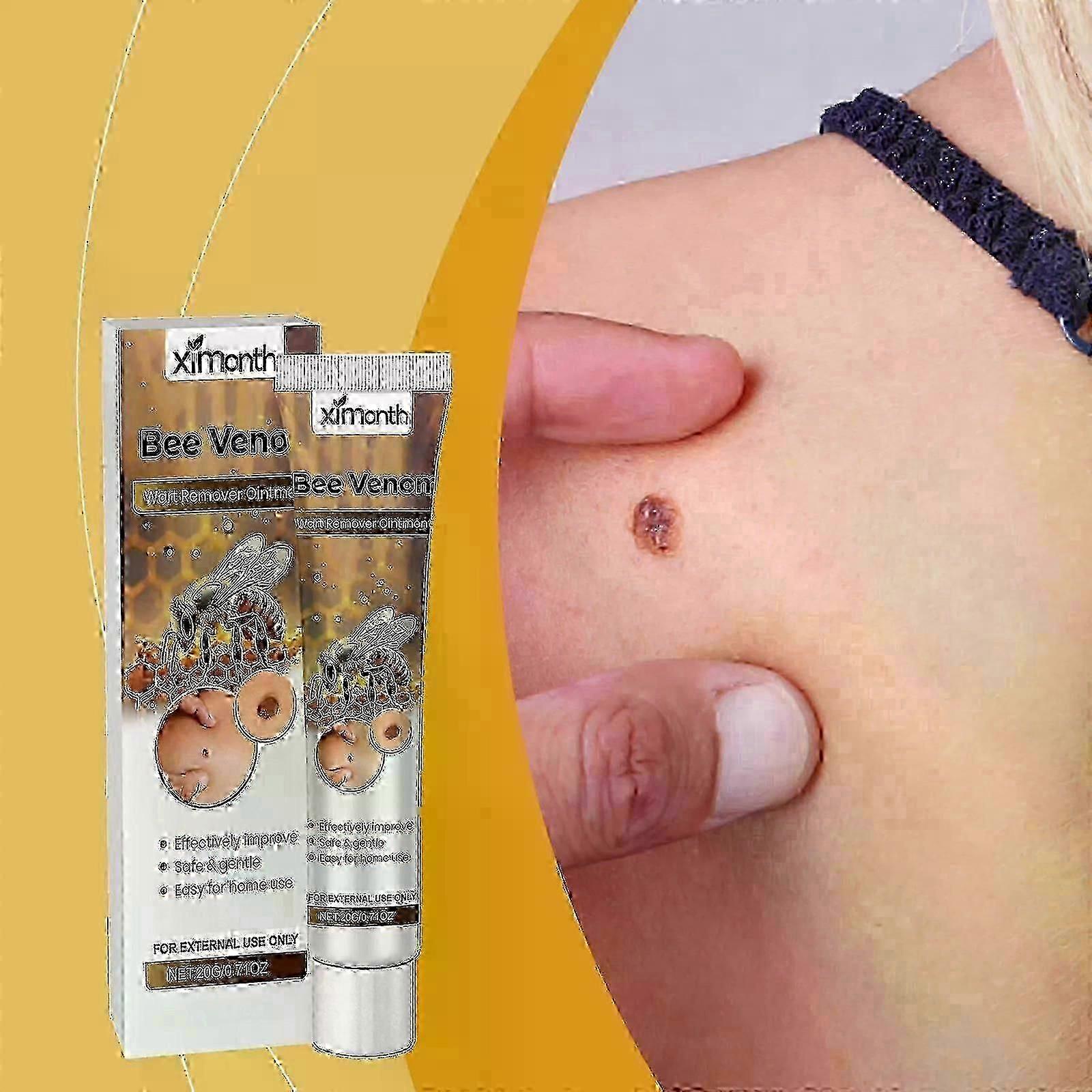 ビーヴェノムクリーム、ビーヴェノムクリーム、ビーヴェノムアンチイボトセラム、イボクリームビーヴェノムクリーム 皮膚の傷を減らす