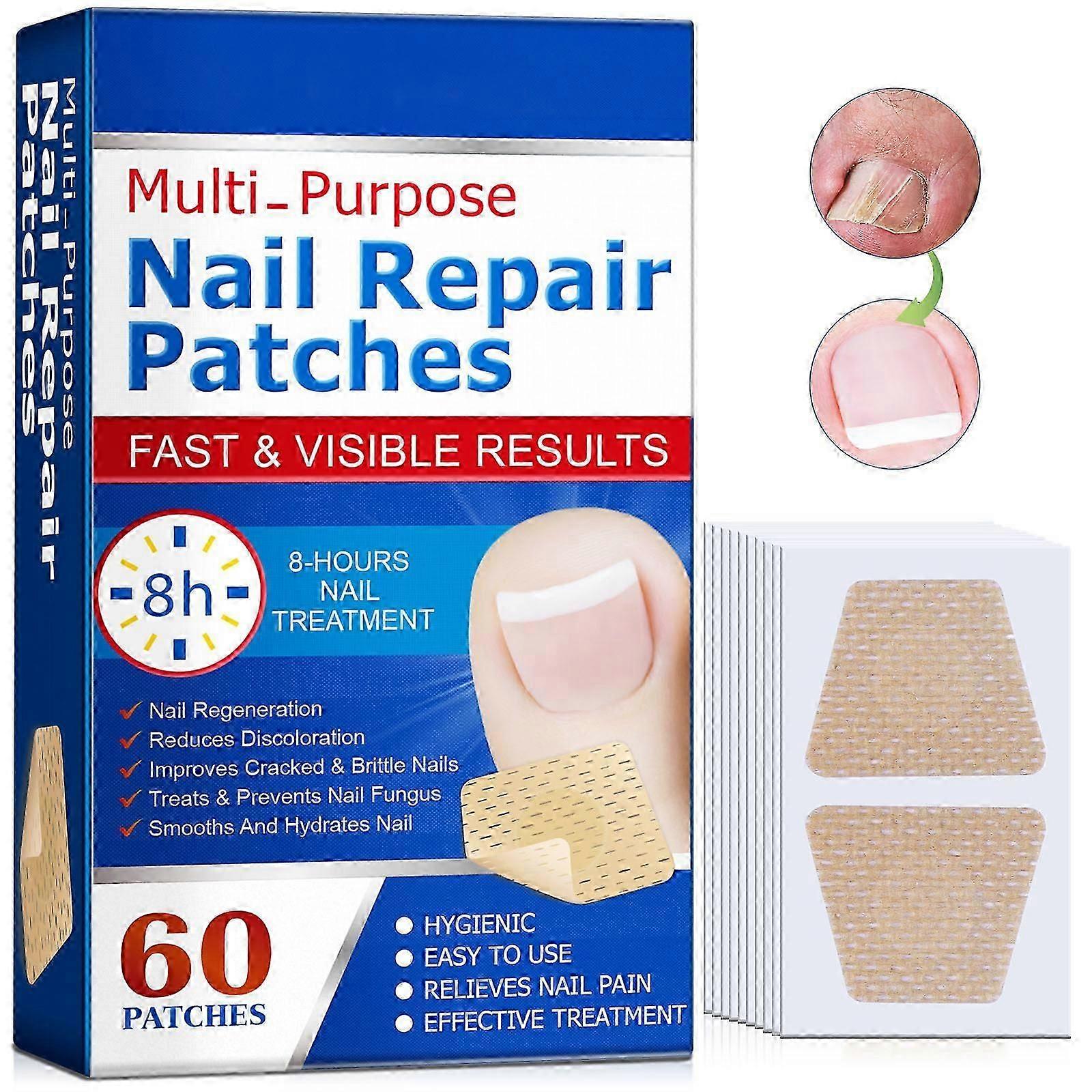 Patchs de réparation des ongles, Traitements des champignons des ongles, Réparation des ongles fendus, Soins des pieds imperméables et respirants Réparation des ongles Patch d’ongles extra forts