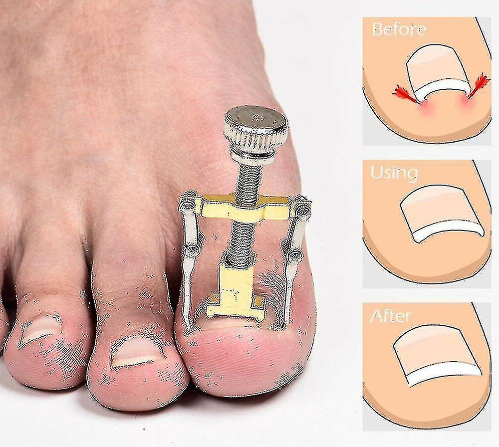 Incarn Toe Mani Pedi Foot Care B Tool Toe Clipper