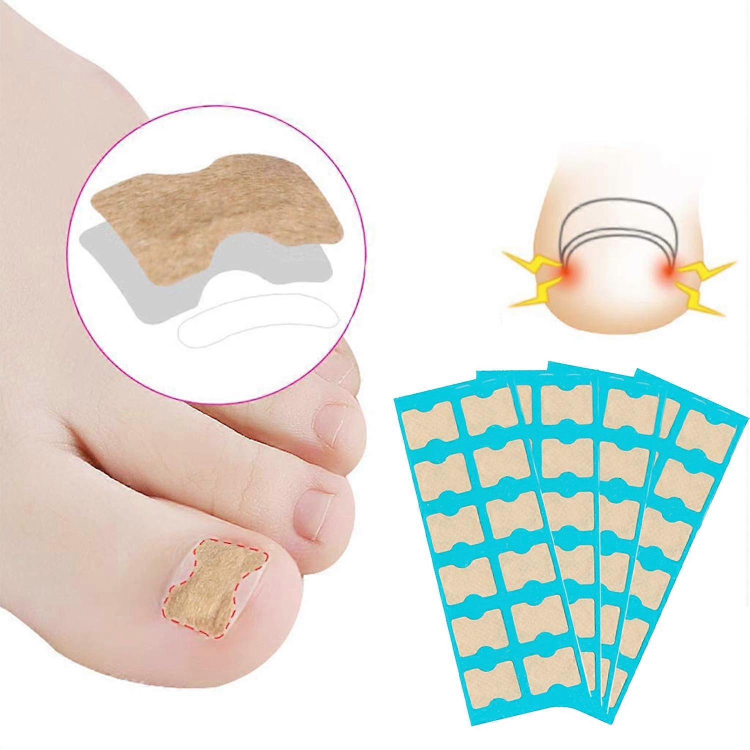 4 Sheets Jelly Glue Toenail Toe Ingrown Corrector Nail Correction Patch Nail Sticker Tool