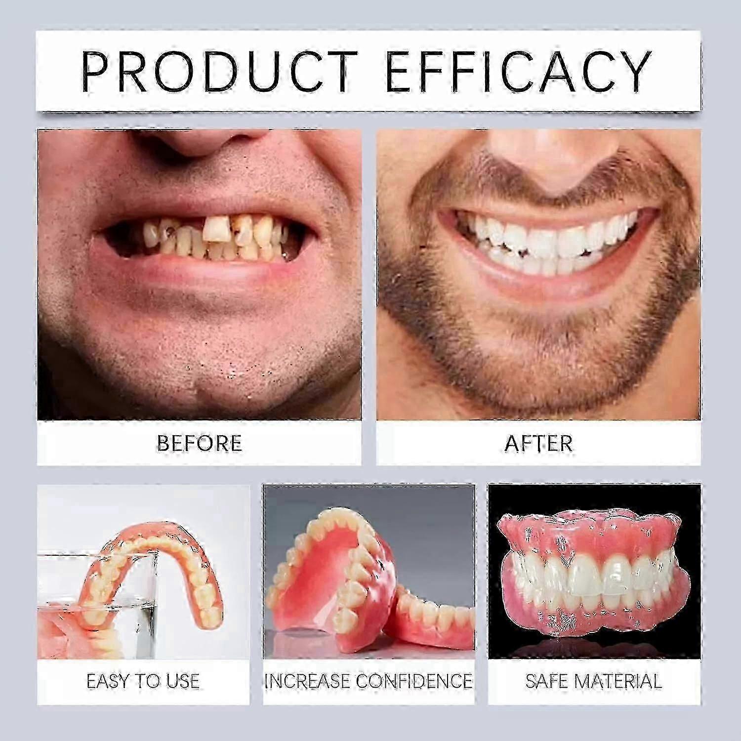 Advanced Customized Full Denture Set, Silicone Reline Denture Set