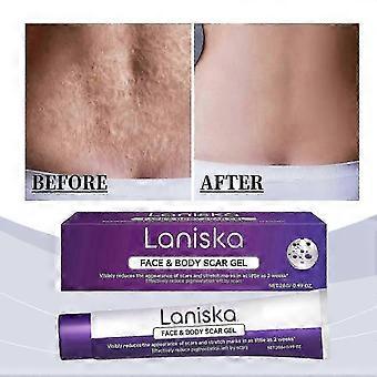 Antifungal Ketoconazole Shampoo 1% - Scalp Treatment for Dandruff, Itchy Relief,