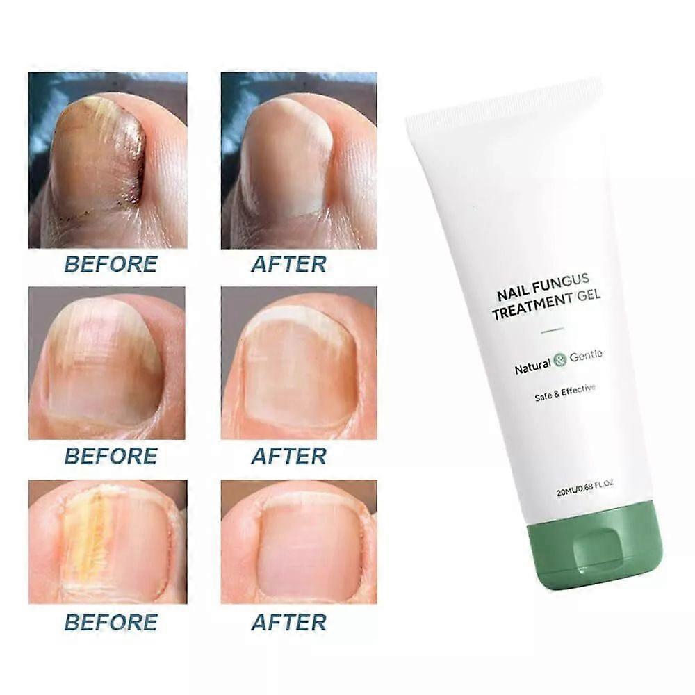 1~3PCS Nutraboost Nail Gelnutraboost 指甲天然指甲修复强化凝胶