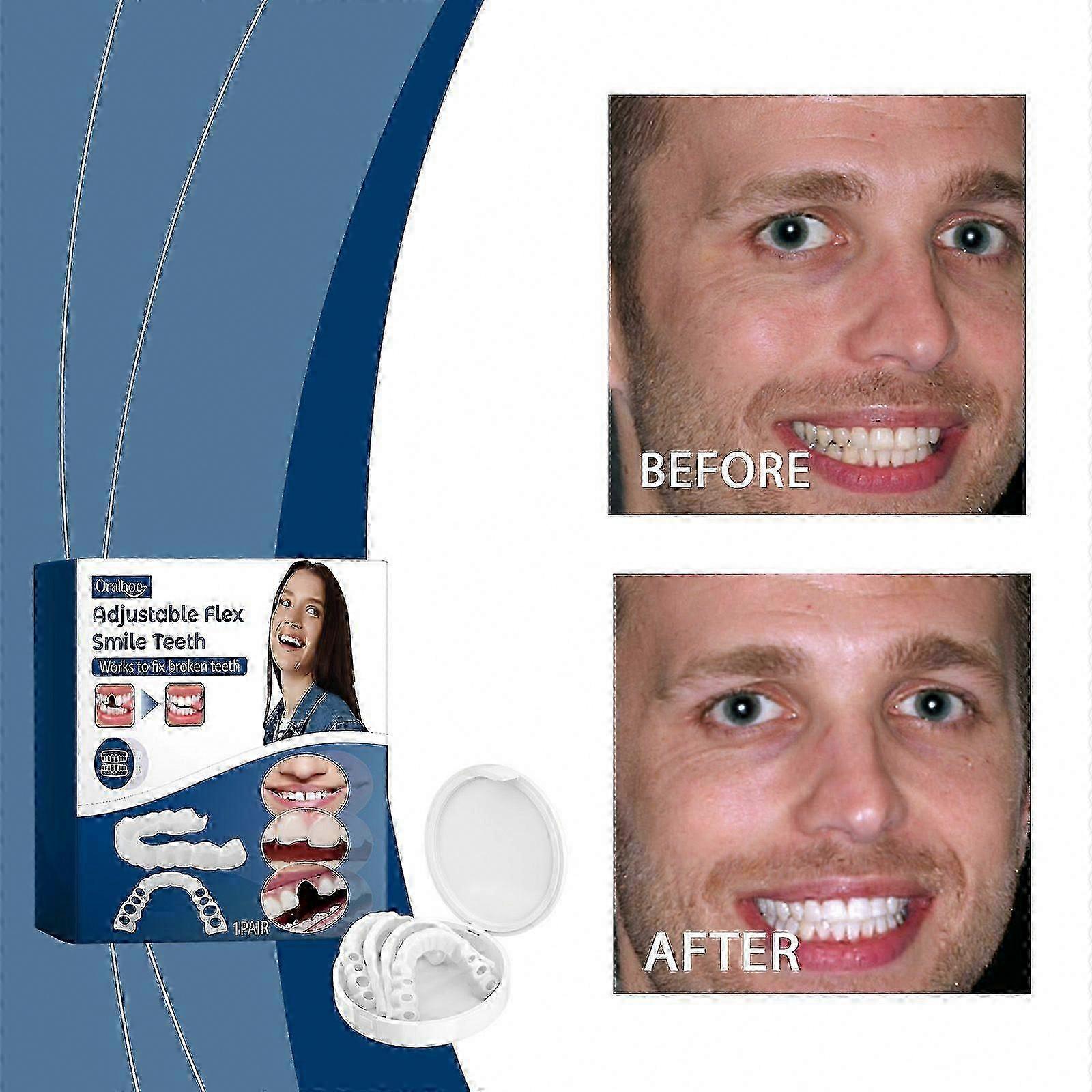 Adjustable Silicone Dentures for Gaps and Misalignment, Quick Cosmetic Teeth Alignment Solution