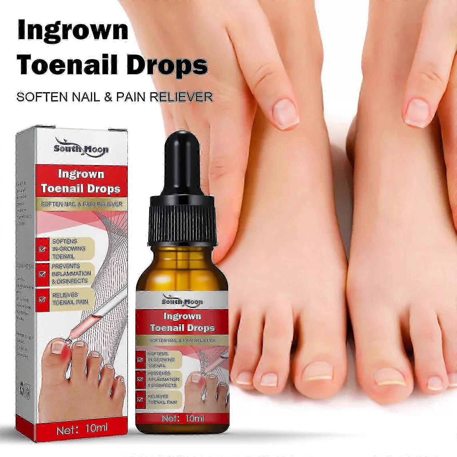 10/30 ml neglehjelper inngrodd tåneglbehandlingsolje, South Moon inngrodd tånegldråper, inngrodd tåneglkorreksjonsbehandlingsolje for smertestillende og så videre