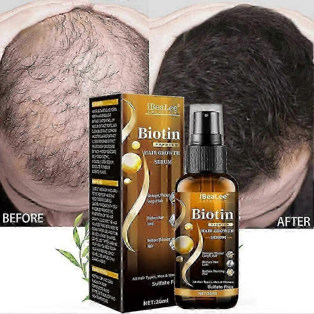 ビオチンの毛の成長のスプレーの反毛損失の速い再生の頭皮の処置の血清20ml
