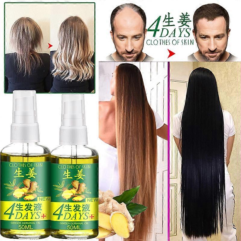 Croissance rapide des cheveux Essence Traitement de perte de cheveux Fluide Croissance des cheveux Naturel Gingembre Essence Spray 50/30/20/10ml