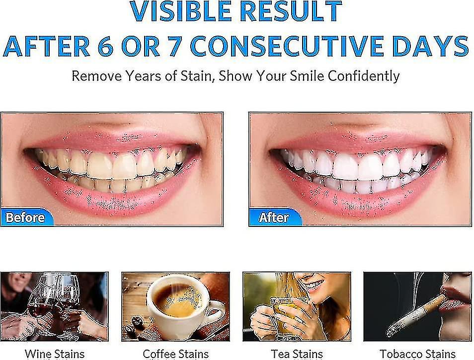 Teeth Whitening Gel, 2030 Mins Teeth Whitener Gels For Sensitive Teeth