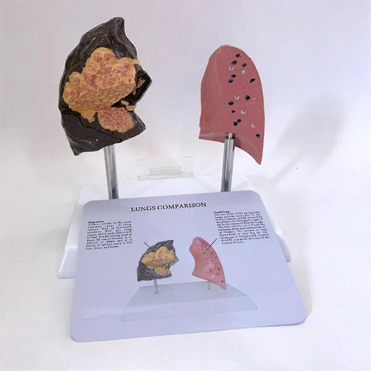 Smoker'S Lung Model Healthy Lung Model Lung Anatomy Model with Pathological Respiratory System Disease Lungs