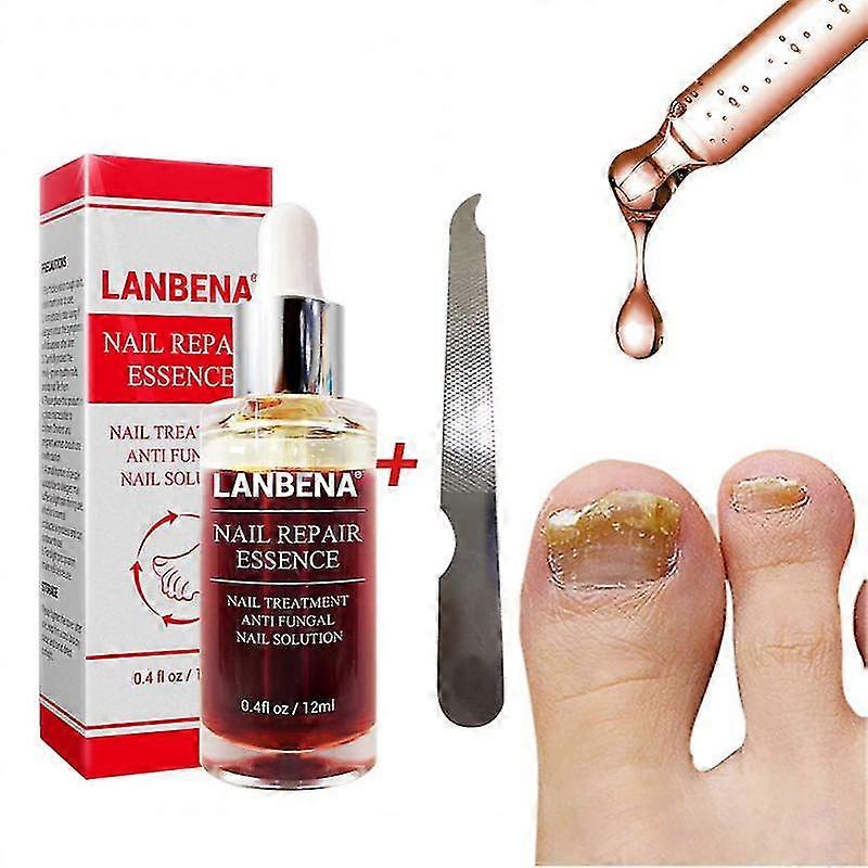 Lanbena unghiilor de reparare a unghiilor lichid tratamentul cu file eficiente anti fungice unghiile