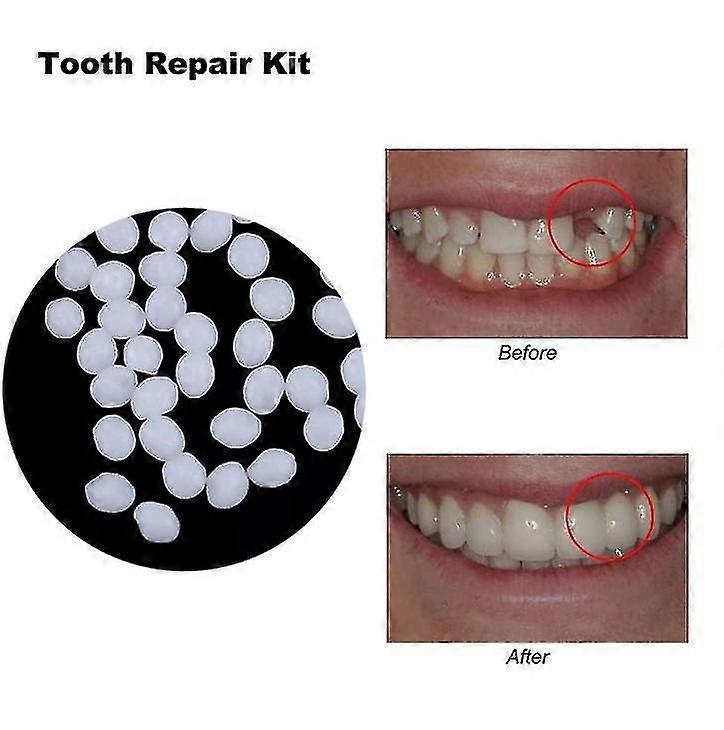 10g / 100g Dents et espace Faux dents Colle solide Résine Dentaire Adhésif Dents Dentiste Faussetés Colle Solide Dent temporaire