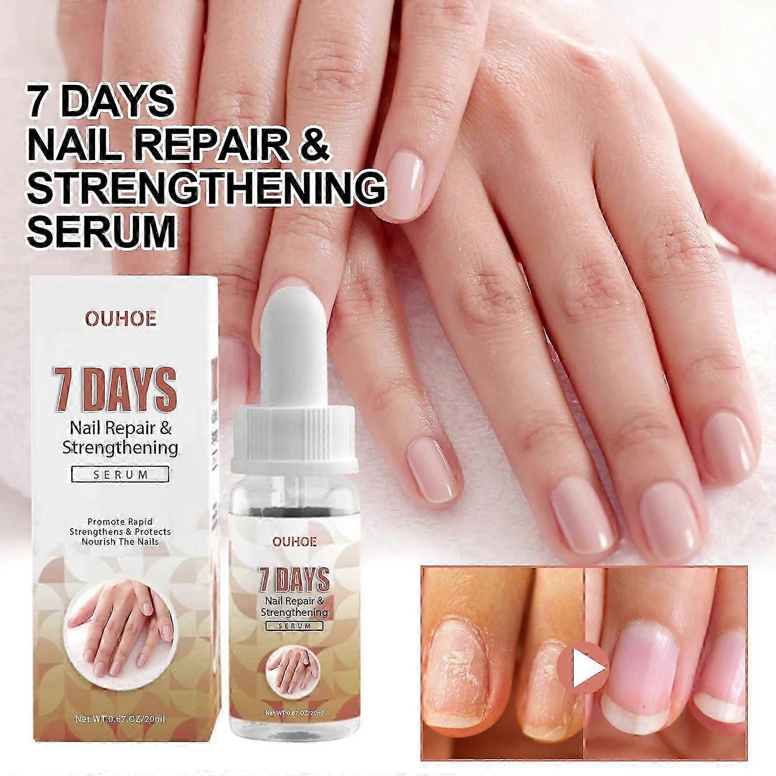 7-Day Nail Repair Serum for Stronger