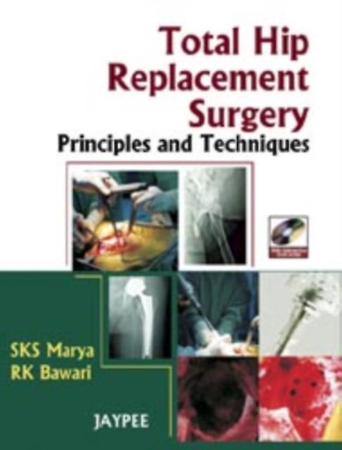 Total Hip Replacement Surgery by RK Bawari Multiplecomponent retail product Book