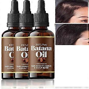 alta qualidade3 Pcs Óleo de Batana Com Alecrim Para - Nutrir o Couro Cabeludo Para