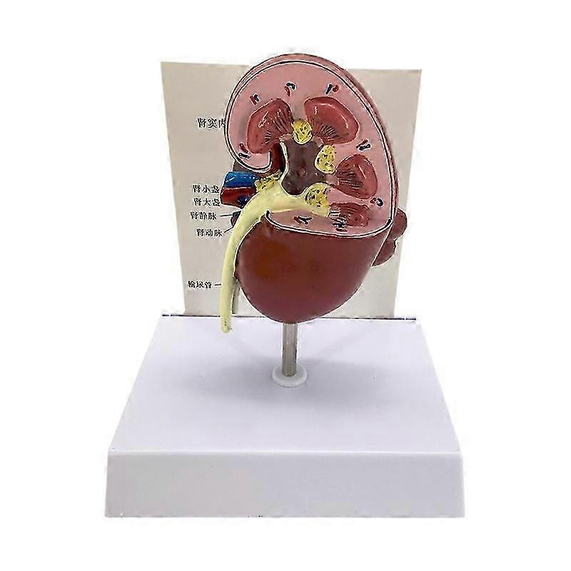 Human kidney disease anatomical model Urinary system communication model-yyds