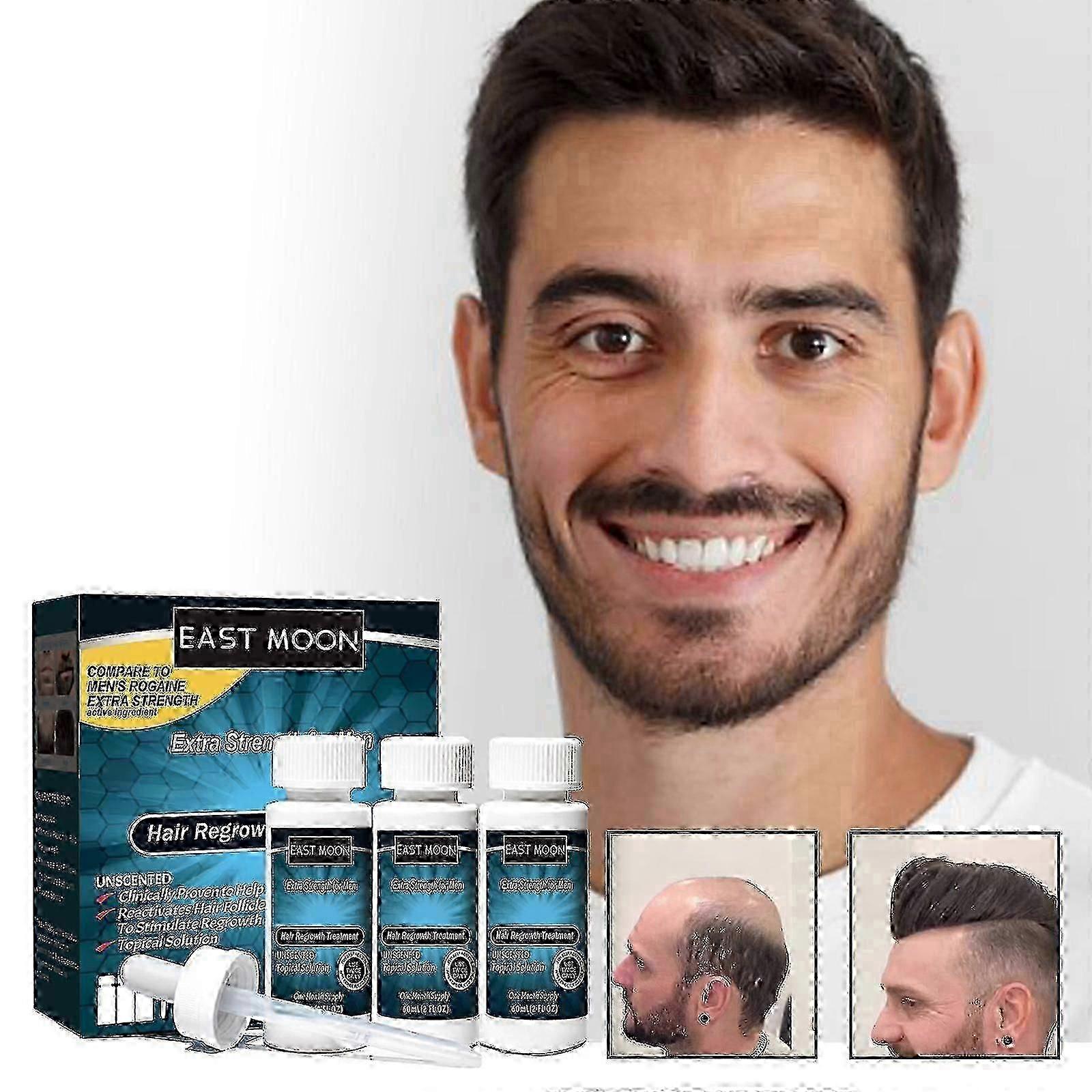 Extra Strength Signature 5% Extra Strength Haarwuchsbehandlung für Männer